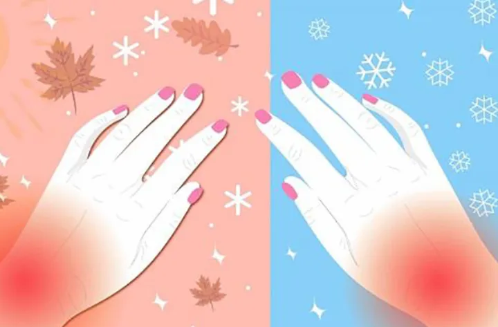 رابطه‌ی روماتیسم مفصلی و سرما چیست؟